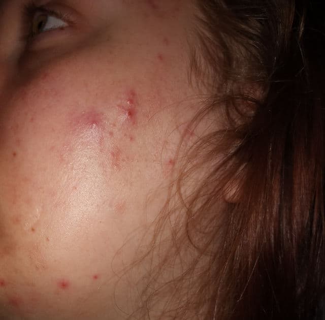 Earth to Skin Super Fruits Blueberry Exfoliating Cleanser review photo by ericherry