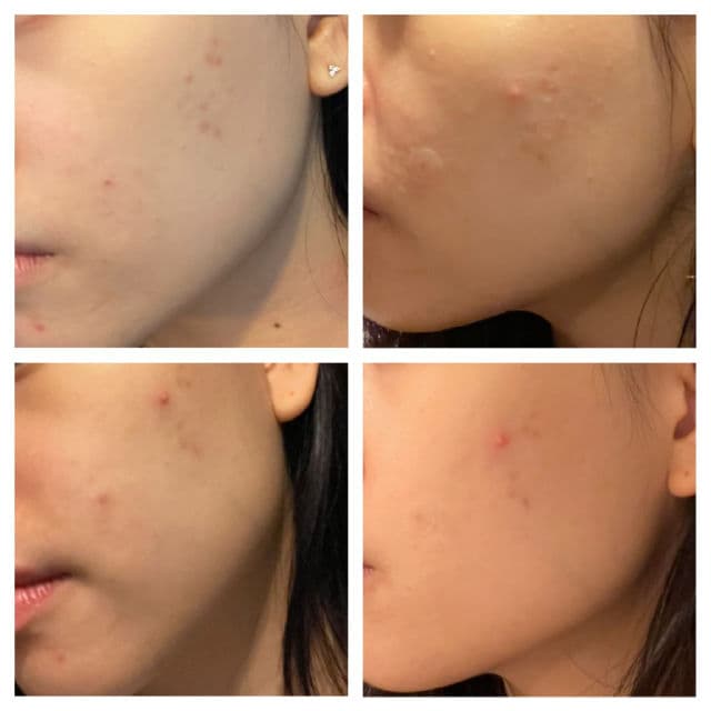 Medicube Zero Foam Cleanser review photo by eunicejx