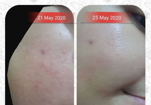 HOLO Sea Cucumber Rejuvenation First Ampoule product review