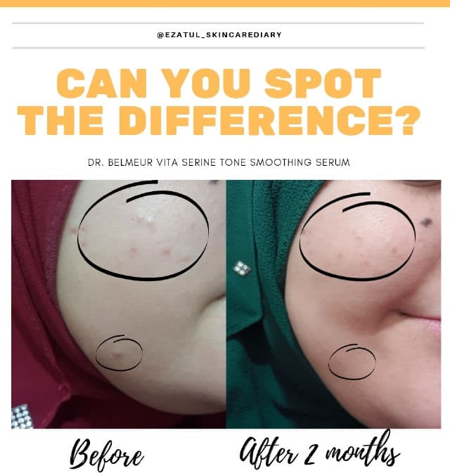 Dr. Belmeur Vita Serine Tone Smoothing Serum product review