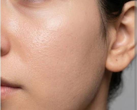 PAPA RECIPE Niacinamide PDRN Brightening Tone-Up Dual-Phase Mist review photo by Asmit