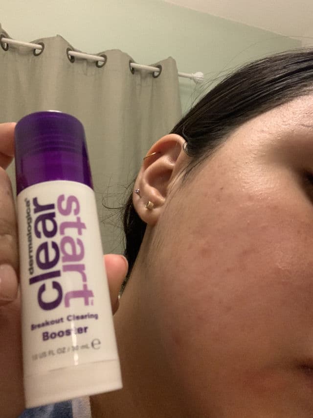 Dermalogica Breakout Clearing Booster review photo by fernanditavel
