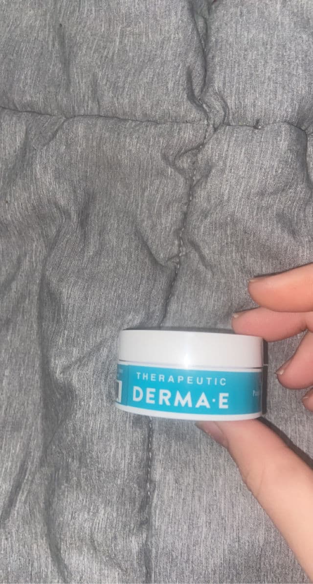 derma e Scar Gel review photo by haleemarie99