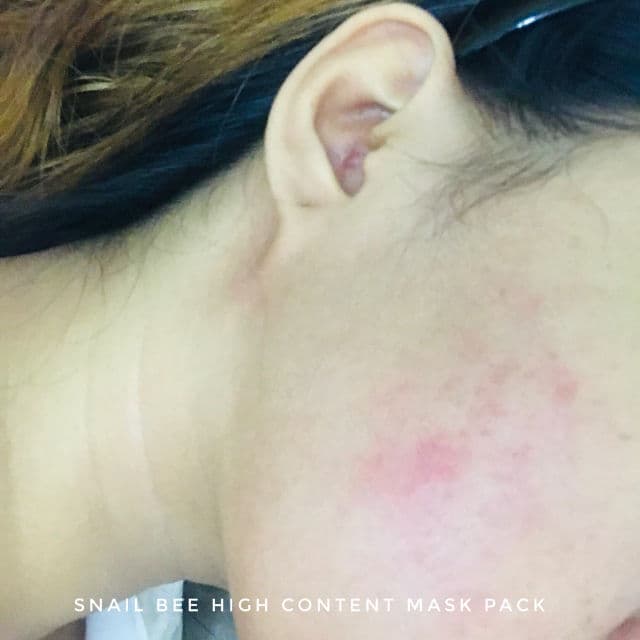 BENTON Snail Bee High Content Mask Pack review photo by hdlums