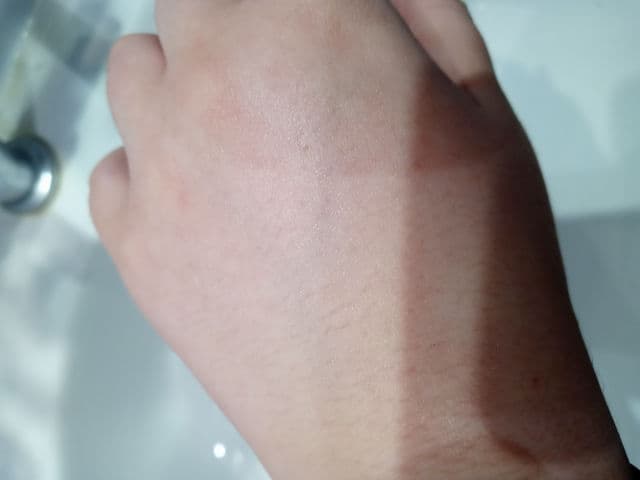 La Roche-Posay Effaclar Adapalene Gel 0.1% Retinoid Acne Treatment review photo by hearties