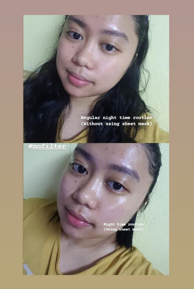 LEADERS Insolution Snail Therapy Skin Clinic Mask review photo by izmelexxie