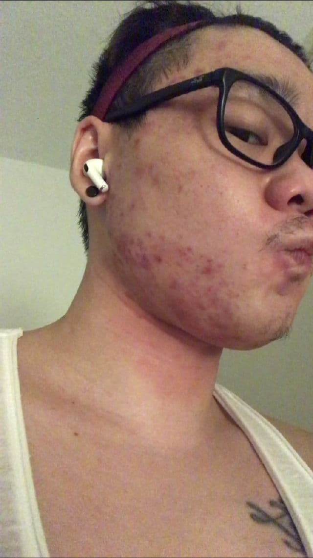 Alluskin Purifying Cleanser review photo by jaredvincenttan