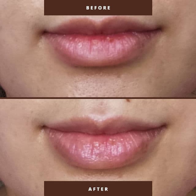 Abib Moisturising Lip Balm Relief Tube review photo by joannelek