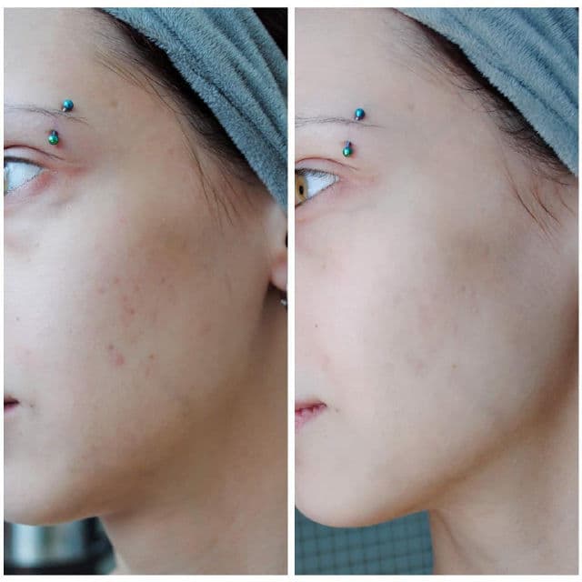 ELIZAVECCA Hell Pore Clean Up AHA Fruit Toner review photo by katefox