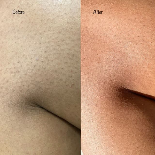 SA Body Wash for Rough & Bumpy Skin product review