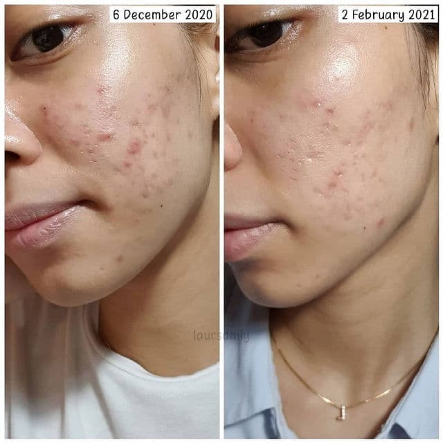 Avoskin Miraculous Retinol Ampoule review photo by lauralionels