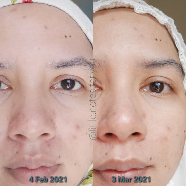 Some By Mi Super Matcha Pore Tightening Serum review photo by littlenotesforyou