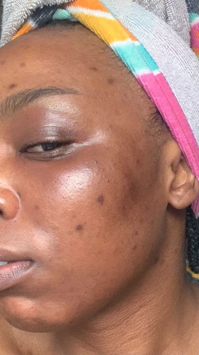 La Roche-Posay Pigmentclar Serum review photo by lovefromnella