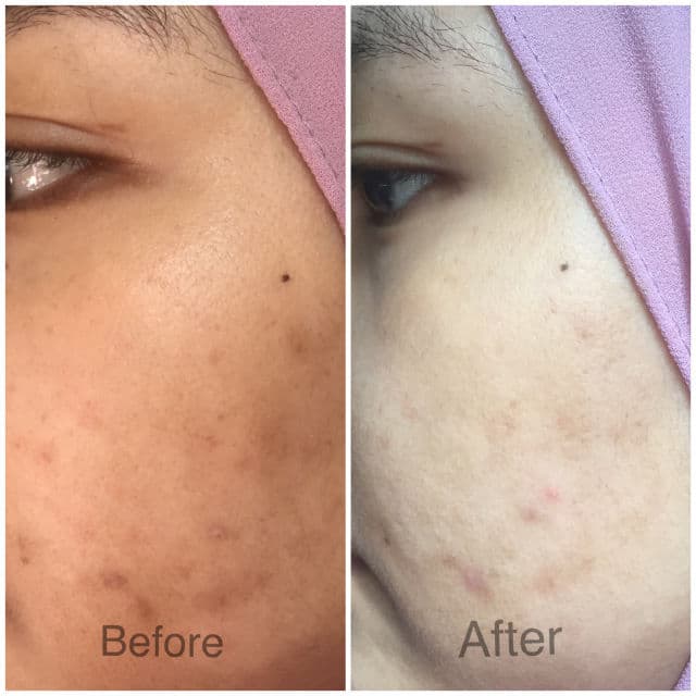 Eucerin Ultrawhite Spotless Double Booster Serum review photo by maddy