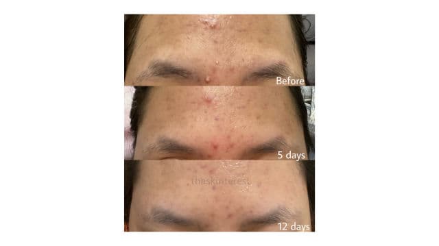 Somethinc Glow Maker AHA BHA PHA Clarifying Treatment Toner review photo by missedvivian
