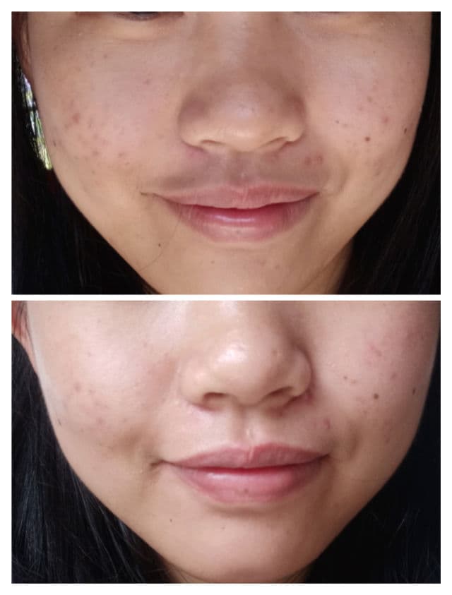 PURITO Pure Vitamin C Serum review photo by mochiface