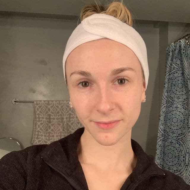 Paula's Choice SKIN PERFECTING 25% AHA + 2% BHA Exfoliant Peel review photo by withinmyskin