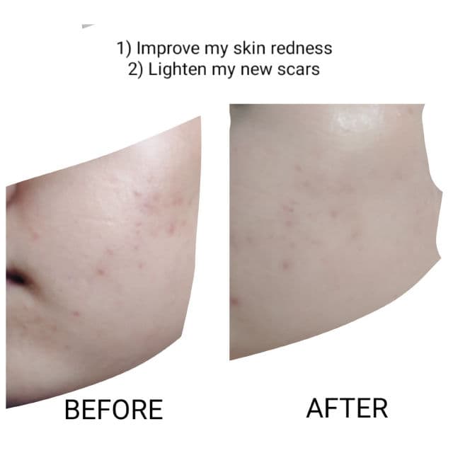 Marine Therapy Dark Spot Correcting Serum product review