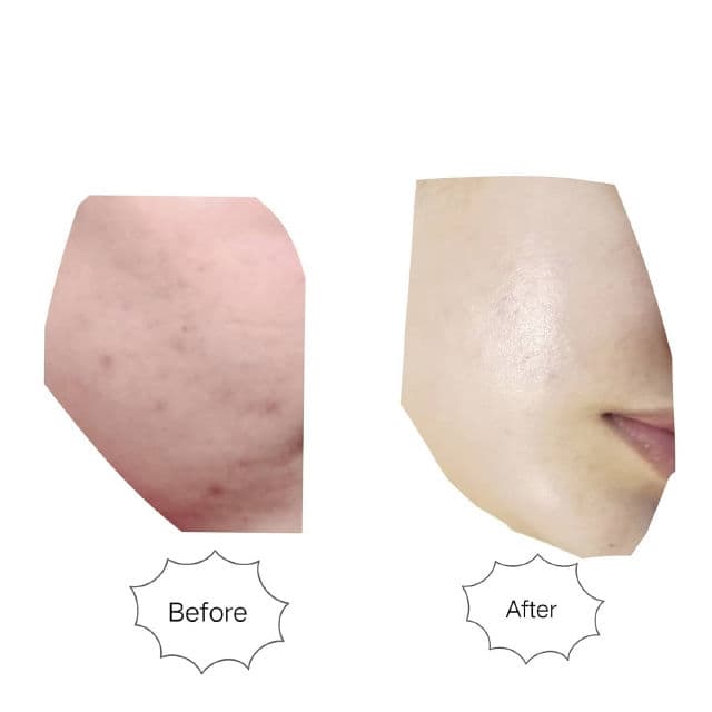 Dermalogy Real Vita C Serum product review