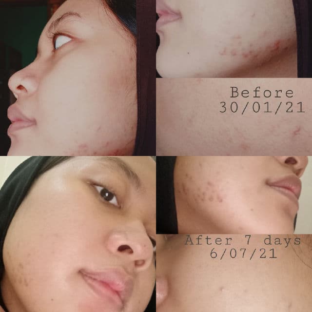 Bloomka Bakuchiol+Vitamin B3 Facial Treatment Serum review photo by nadianatasyaah