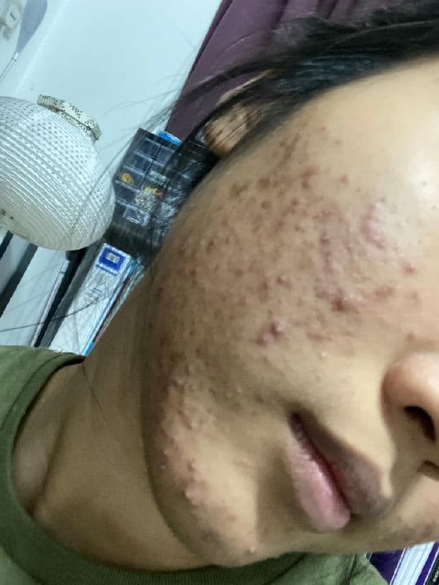 Alluskin Purifying Cleanser review photo by Ellyssa