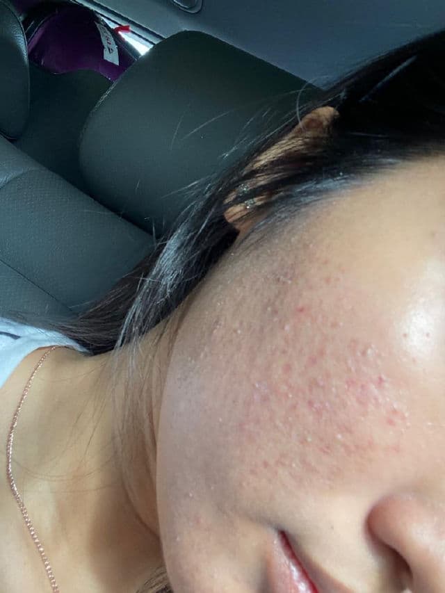 Alluskin Purifying Cleanser review photo by Ellyssa