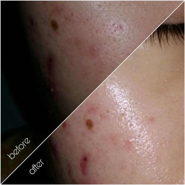 LEADERS Mediu Amino Clearing Mask review photo by niahanamide