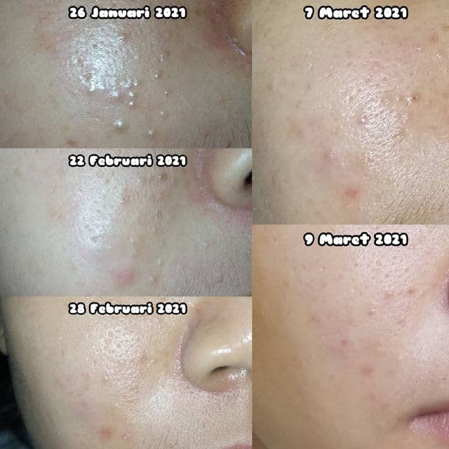 Avoskin Your Skin Bae Marine Collagen 10% + Ginseng Root review photo by nindysarchive