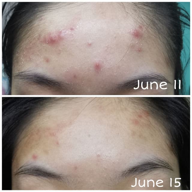Fresh Formula Doctor Clear Overnight Repair Cream review photo by reviewsbynor