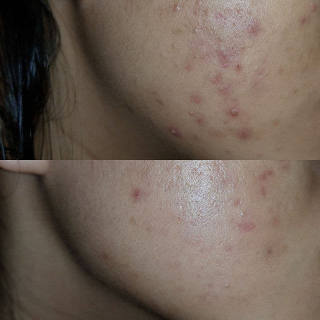 Votre Peau Serum Vitamin C - Maharis Clinic review photo by qntmrmdhn