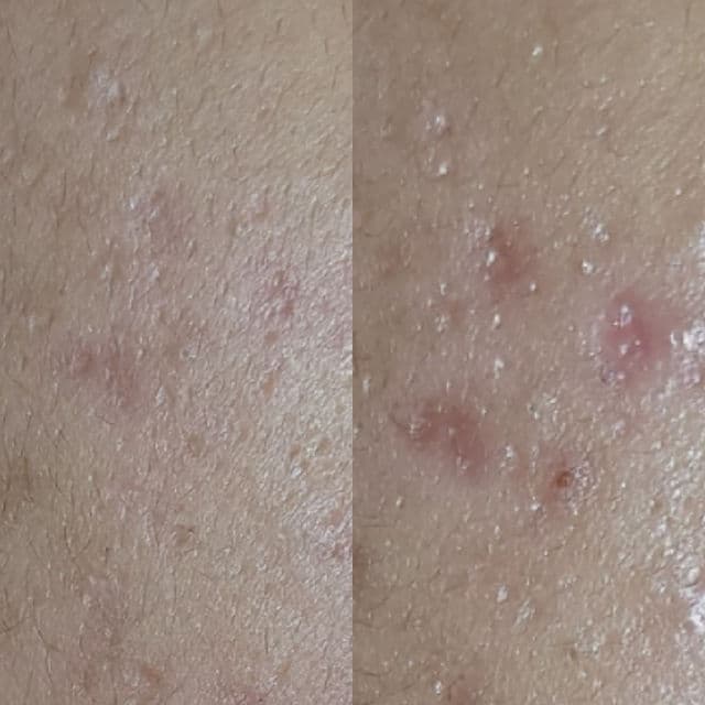 Votre Peau Serum Vitamin C - Maharis Clinic review photo by qntmrmdhn