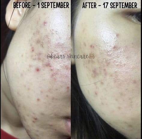 Sbcskin VIT C 15 Skin Booster & Antioxidant Serum review photo by ranbear