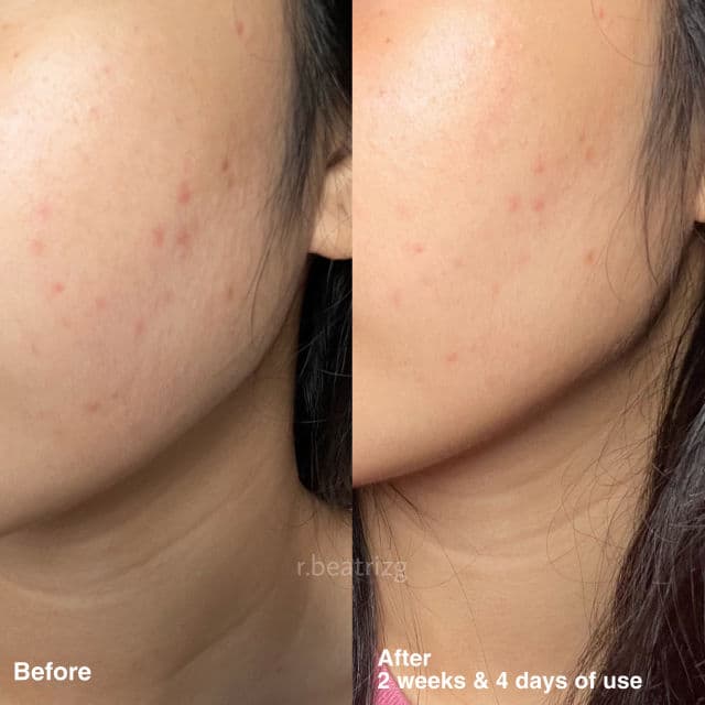 Snail White Glow Potion AHA BHA Toner review photo by rbeatrizg