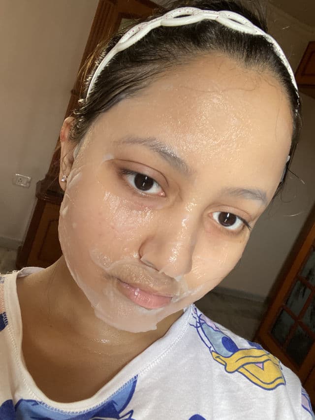 MEDIHEAL N.M.F Aquaring Ampoule Mask Ex review photo by riyaarolkar