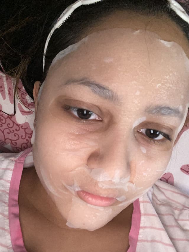 MEDIHEAL Vita Lightbeam Essential Mask EX review photo by riyaarolkar