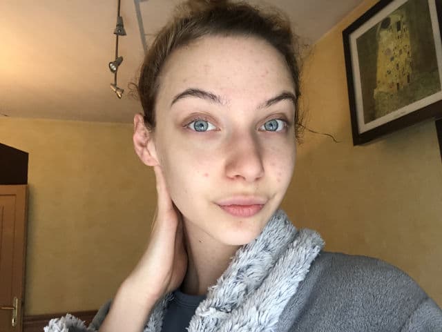 Geek & Gorgeous Cheer Up 6% Mandelic + BHA Liquid review photo by sabaao