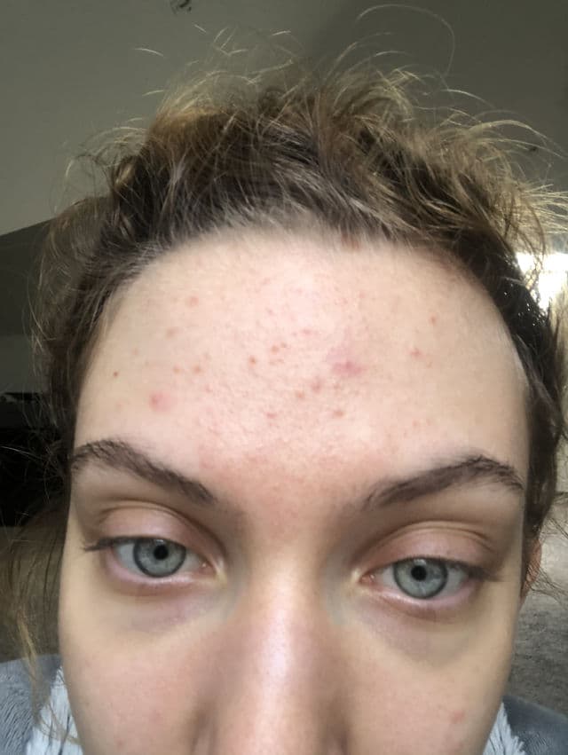 Geek & Gorgeous 101 aPAD 20% Azeclair Serum review photo by sabaao