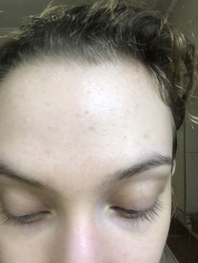 Geek & Gorgeous 101 aPAD 20% Azeclair Serum review photo by sabaao