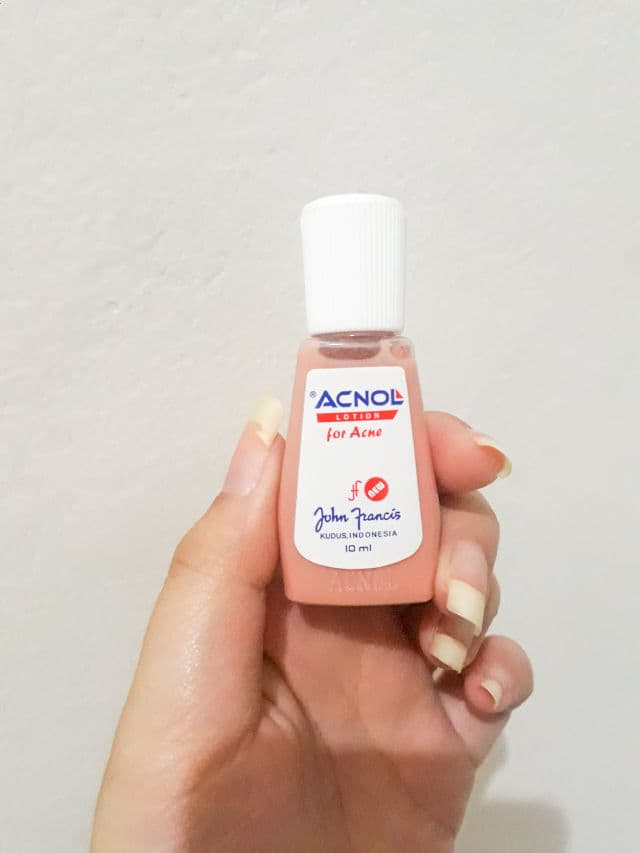 Acnol Lotion for Acne review photo by shellaemnl