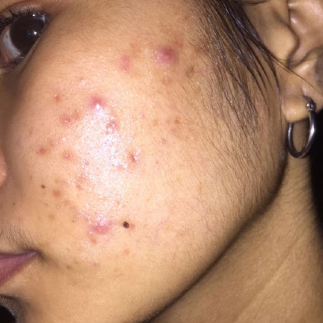 By WISHTREND [Discontinued] Pure Vitamin C 15% with Ferulic Acid review photo by skincarebykaye