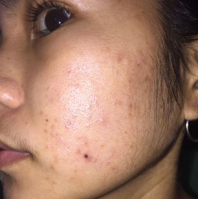 By WISHTREND [Discontinued] Pure Vitamin C 15% with Ferulic Acid review photo by skincarebykaye