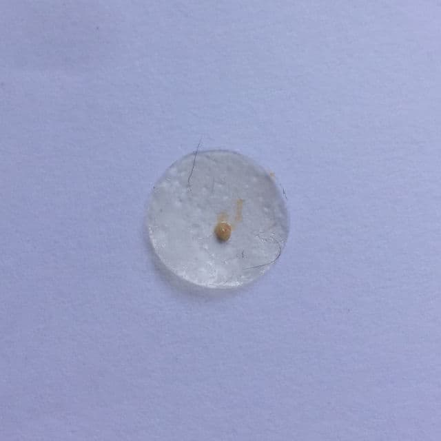 Neulii AC Clean Saver Spot Patch review photo by skincarebykaye
