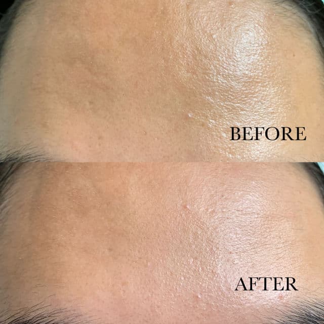 Schwanen Garten Antioxidant Ampoule review photo by skincareinhawaii