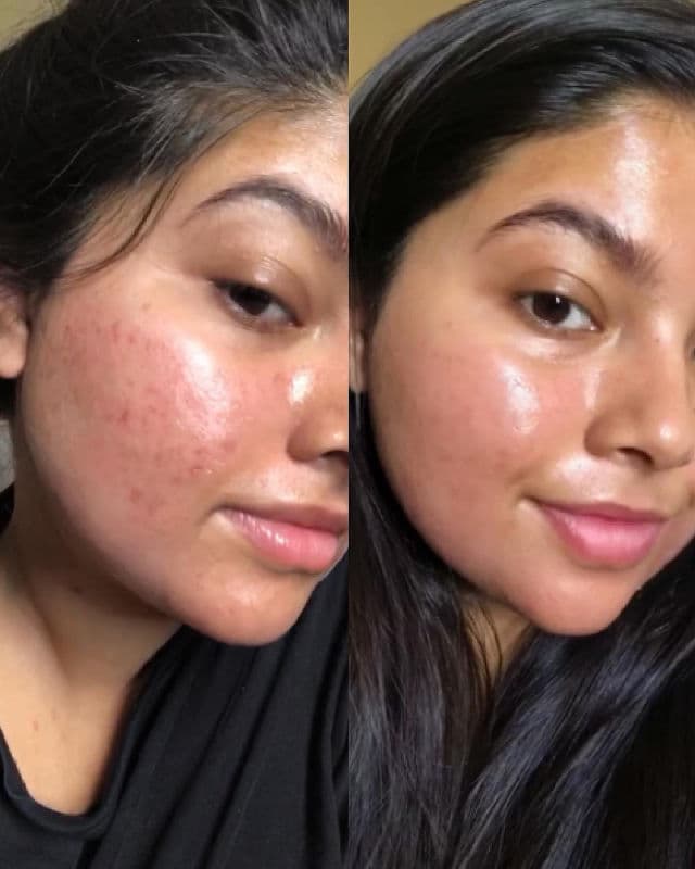 Paula's Choice Clinical Discoloration Repair Serum review photo by skincarewithorr