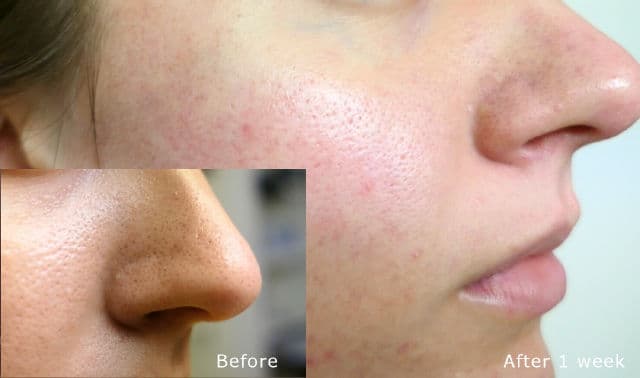 COSRX Salicylic Acid Daily Gentle Cleanser review photo by sofiia