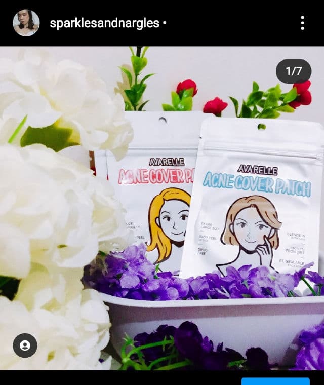 Avarelle Acne Cover Patch review photo by sparklesandnargles
