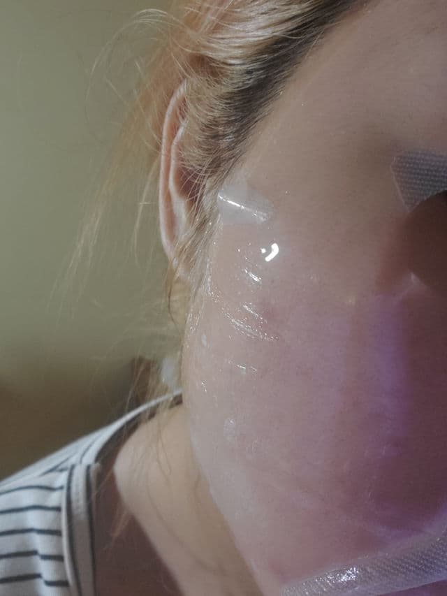 Ebanel Hyaluronic Collagen Sheet Mask review photo by starry