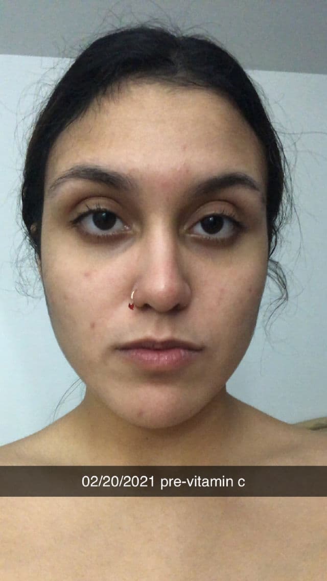 Peach & Lily Transparen-C Pro Spot Treatment review photo by stephaureus