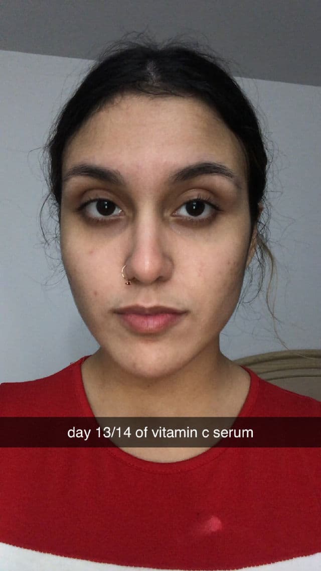 Peach & Lily Transparen-C Pro Spot Treatment review photo by stephaureus