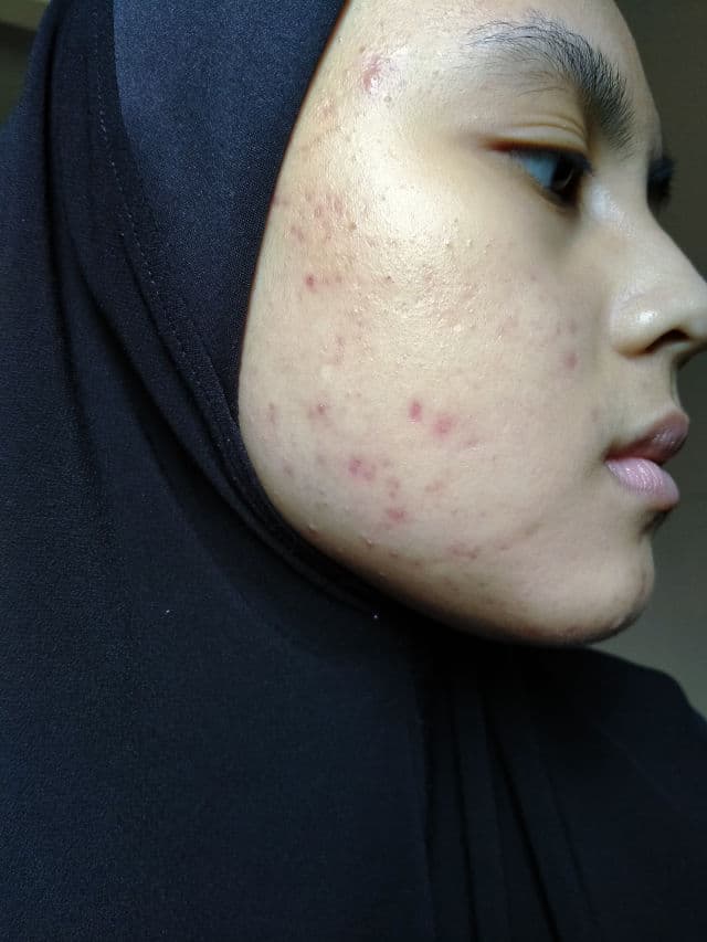 L'ESSENTIAL Double Serum review photo by sweetie